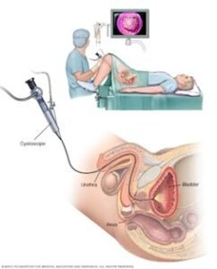 diagnostic cystoscopy for men